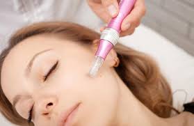 Have you tried micro-needling yet?